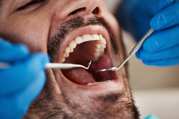 Dental X-Rays and Imaging in Auburn, AL